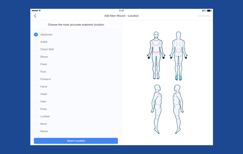 Inteliwound screenshot 2